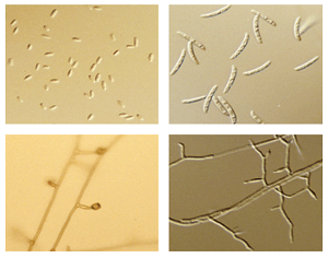 Fusarium oxysporum in culture